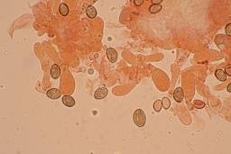 Cortinarius pratensis