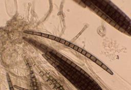 Trichoglossum hirsutum