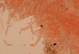 Spodocybe trulliformis