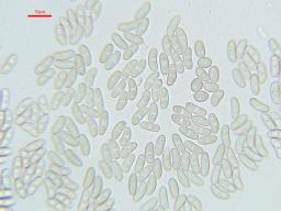 Tympanopsis confertula