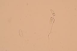 Calycina citrina
