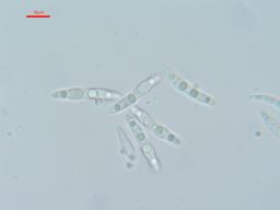 Setoseptoria arundinacea