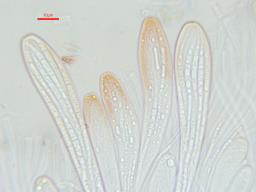 Therrya pini var. pini