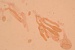 Hygrophorus hyacinthinus