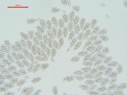 Tympanopsis confertula