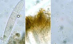 Vexillomyces atrovirens