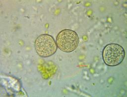 Tranzschelia pruni-spinosae