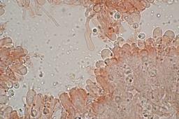 Resupinatus striatulus