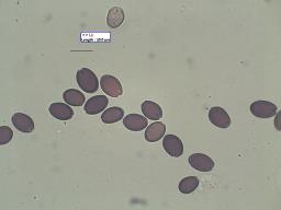 Stropharia rugosoannulata