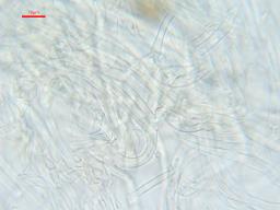 Polycephalomyces ditmarii