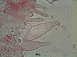 Melanoleuca subalpina