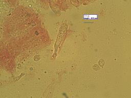 Atheniella leptophylla