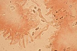 Pseudotricholoma metapodium