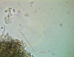 Pyrenopeziza petiolaris