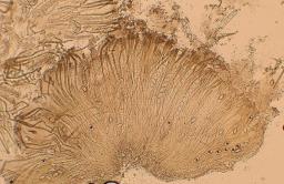Psilopezia nummularia