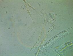 Hymenoscyphus eichleri