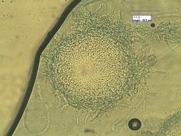 Hypomyces lateritius