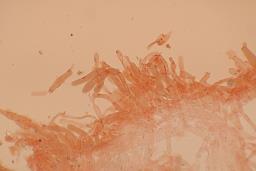 Spodocybe trulliformis