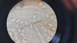 Lasiobolus ciliatus