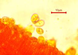 Tubaria furfuracea