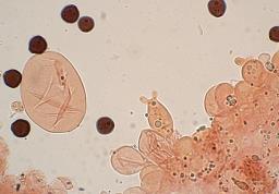 Narcissea cordispora