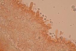 Callistosporium luteo-olivaceum