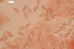 Lepiota oreadiformis