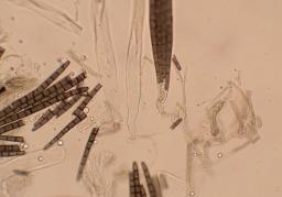 Trichoglossum hirsutum