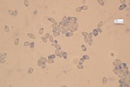 Pseudoporpoloma pes-caprae