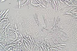 Neonectria punicea