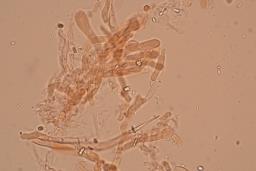 Byssomerulius corium