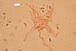Pseudotricholoma metapodium
