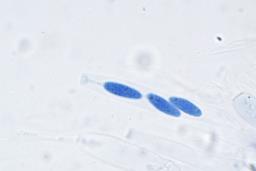Neonectria punicea