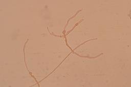 Hohenbuehelia petaloides