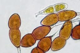 Puccinia buxi