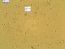 Atheniella leptophylla