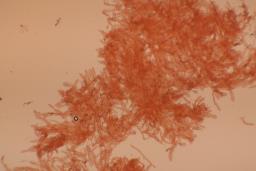 Pseudoporpoloma pes-caprae