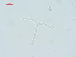 Orbilia pseudoaristata