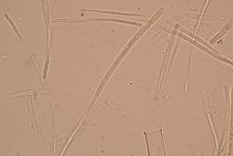 Lanzia luteovirescens