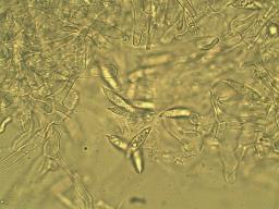 Hypomyces lateritius