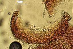 Neonectria punicea