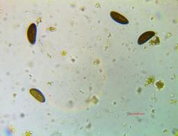 Hypoxylon pseudofuscum