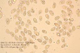 Melanoleuca friesii