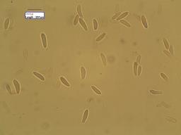 Mollisia melaleuca