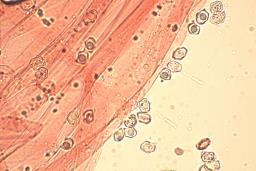Entoloma undulatosporum