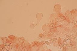 Lepiota oreadiformis