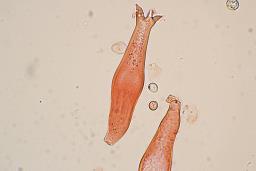 Pluteus petasatus