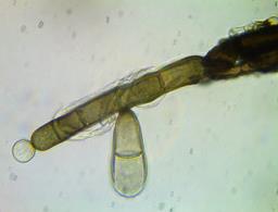 Helminthosporium velutinum