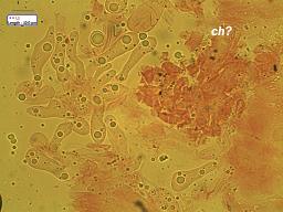 Atheniella leptophylla