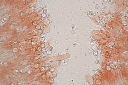 Resupinatus striatulus